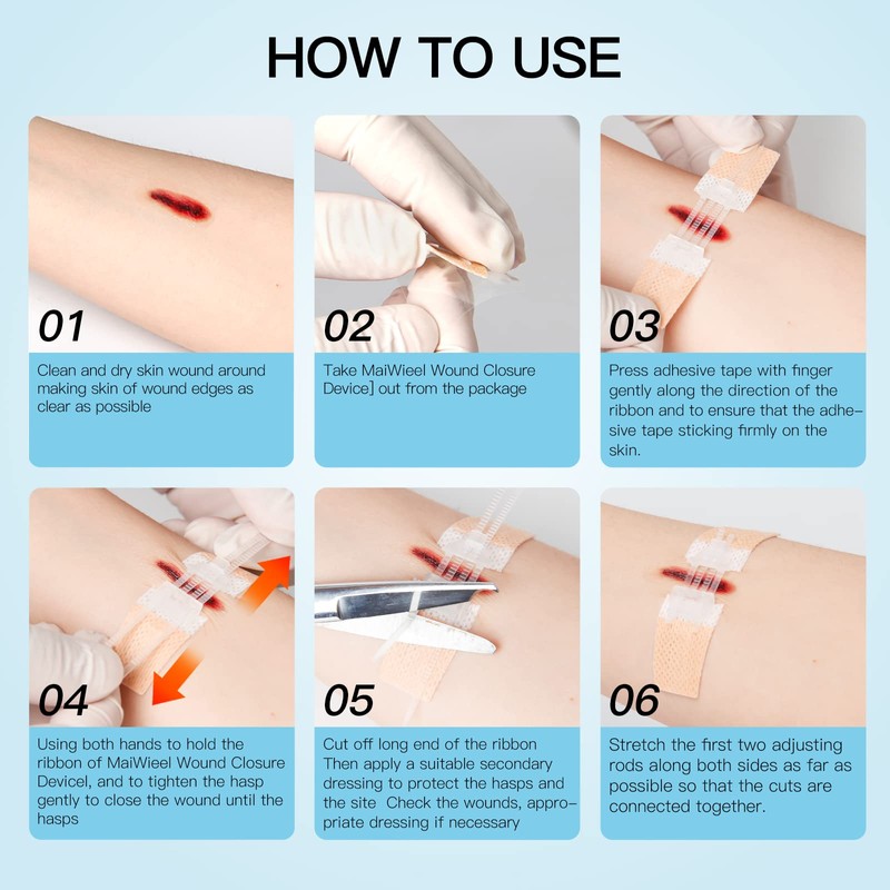 Zip Stitch Laceration Repair Without Stitches Butterfly Bandaids Quick Clot