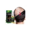 El Sérum Para El Crecimiento Del Cabello Promueve El Crecimi