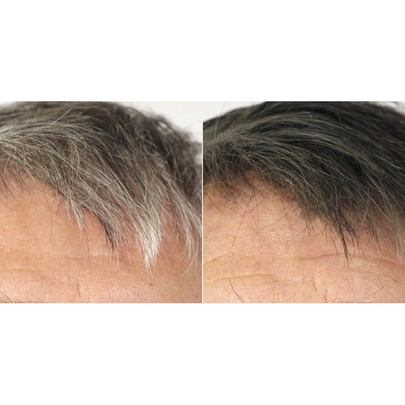120 parasite and candida cleanse - ANTI-GRAY HAIR - ANTI-PARASITE