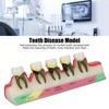 Dental Teeth Model Ceramic Clear Structure Oral Care Educational Periodontal