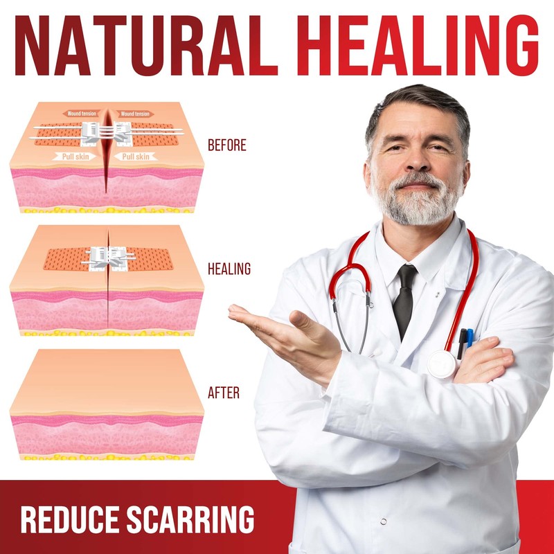 Emergency Wound Closure Strips - 2pk - Laceration Closure Kit