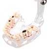 Standard Dental Model for Dentistry Students, Standard Study Teaching Dental