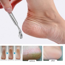 Fußfeilen-Set – Pediküre Fußfeile Schaber für abgestorbene harte Haut Entferner Ferse Mais rissige Haut Entfernung – Edelstahl Professionelle Fußraspel Kit Fußpflege Werkzeuge für Füße Hand Silber