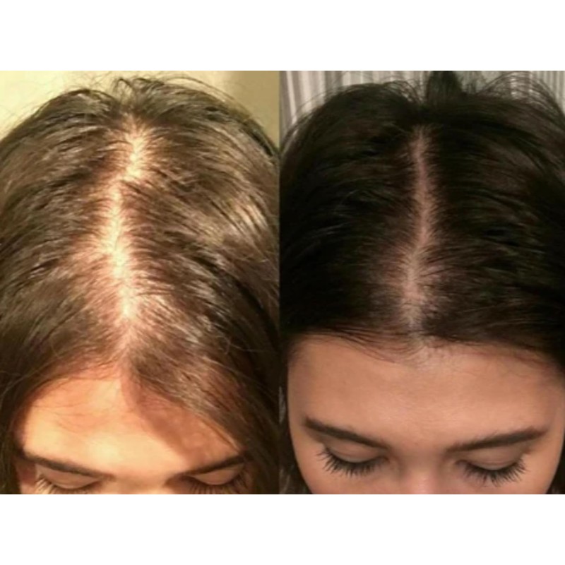 Capelli Fibras Capilares para Pérdida de Cabello, Polvo de Disimulación