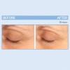 Serious Skincare- - Eyetality Pm Total Eye Care - Night