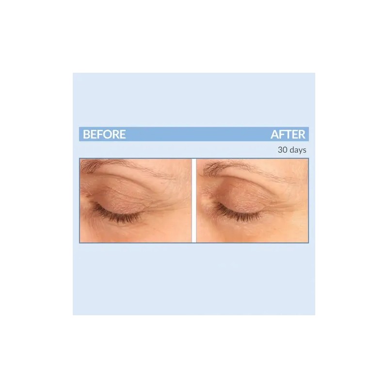 Serious Skincare- - Eyetality Pm Total Eye Care - Night
