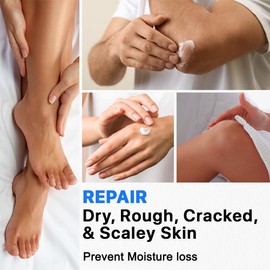 resdam Urea Cream 40%, Keratolytic Foot Cream for Dry Cracked Heels, Feet, Knees, Elbows, Hands, Cuticle, Callus Remover, Skin Barrier Repair (1)