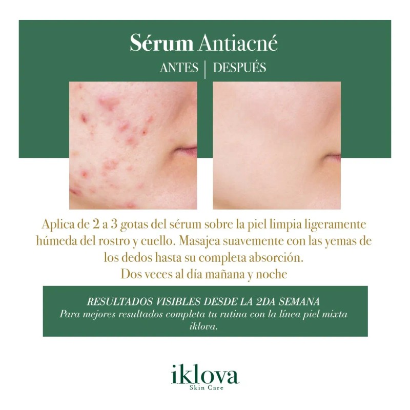 Sérum Piel Mixta Ácido Hialurónico Antiacné Iklova