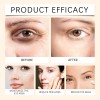 Crema Para Ojos Crema Eficaz Para Ojos Oscuros Crema F