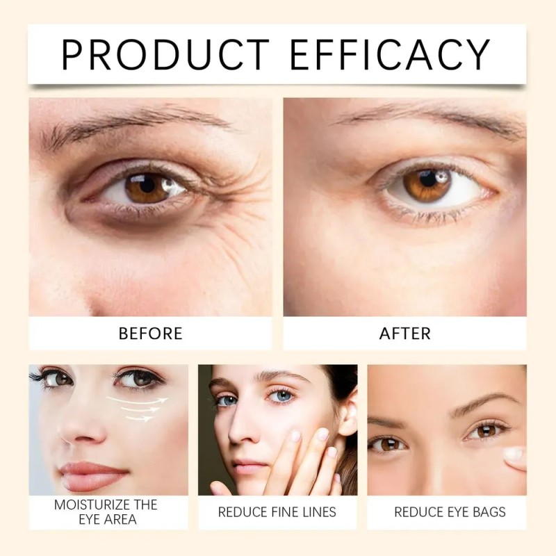 Crema Para Ojos Crema Eficaz Para Ojos Oscuros Crema F
