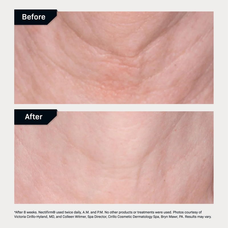 Revision Skincare Nectifirm®, Anti Aging Neck Firming Cream for Reducing