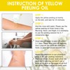 YAFUSIPE Yellow Peeling Oil for Dark Skin Strong Peel Oil
