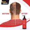 DHT Champú y acondicionador para la pérdida de cabello con