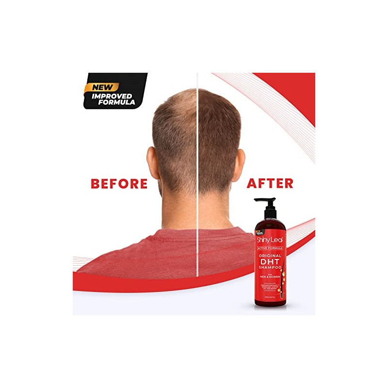 DHT Champú y acondicionador para la pérdida de cabello con
