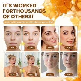 Organic Grass-Fed Beef Tallow Balm with Raw Honey - Moisturizing Cream for Soft, Smooth Skin - Handmade All-Natural Moisturizer - Radiant Skin - Quantity: 2 Bottles