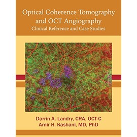 Optical Coherence Tomography and OCT Angiography: Clinical Reference and Case Studies