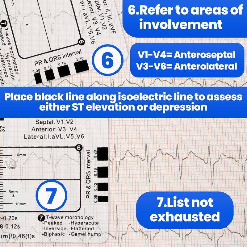 BEIQIYA 3pcs ECG 7 Step Ruler, Transparent EKG Calipers Ruler,