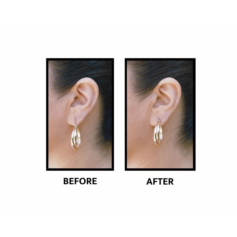 Lobe Wonder - The Original Ear Lobe Support Patch for