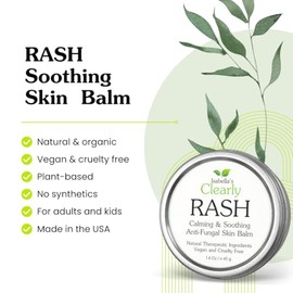 Isabella's Clearly RASH, Bálsamo Calmante para la Piel, Ayuda a Aliviar la Picazón, las Erupciones Cutáneas y la Piel Seca Irritada | Producto Natural