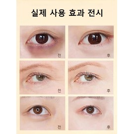 다크써클 아이패치 주름개선 미백 아이마스크팩 눈가 붓기완화/눈밑 지방제거/눈밑꺼짐 제거 Dark Circle Eye Patch for Wrinkle Improvement and Whitening Eye Mask Pack – Reduces Puffiness Around Eyes, Removes Under-Eye Fat, Eliminates Under-Eye Hollows