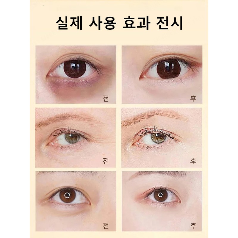다크써클 아이패치 주름개선 미백 아이마스크팩 눈가 붓기완화/눈밑 지방제거/눈밑꺼짐 제거 Dark