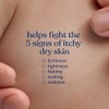 Johnson Moisturizing Pink Baby Lotion With Coconut Oil Hypoallergenic And