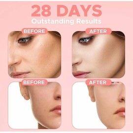 4 in 1 Facial Serum, 10% Hyaluronic Acid, 5% Niacinamide, 30% Vitamin C, 10% Vitamin E, 1.01 fl oz