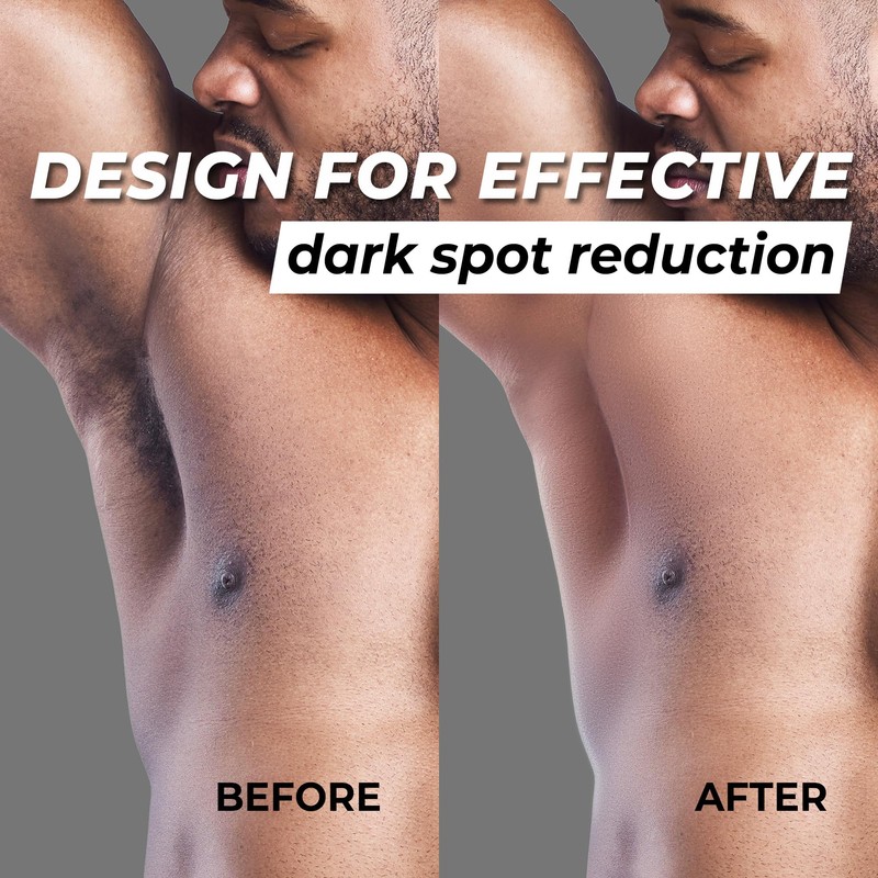 Abera Armpit Roller with Betel Leaf, Green Tea Rice Bran,