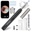 JEGOAT Ear Wax Removal Kit Tool Otoscope w/ 1296P HD