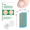 Professional Ingrown Toenail Corrector Kit - Curved Nail Strips &