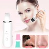 Limpiador Facial Ultrasónico Exfoliante Espinillas Belleza Blanco