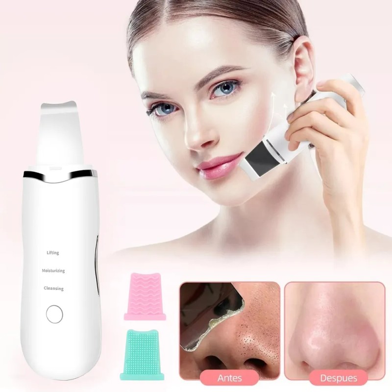Limpiador Facial Ultrasónico Exfoliante Espinillas Belleza Blanco