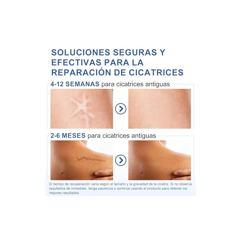 4M Parches de Silicona para Cicatrices, Cinta Medica Reutilizable Cuidado
