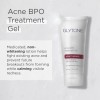 Glytone Gel De Tratamiento Bpo Para El Acné, Con Peróxido
