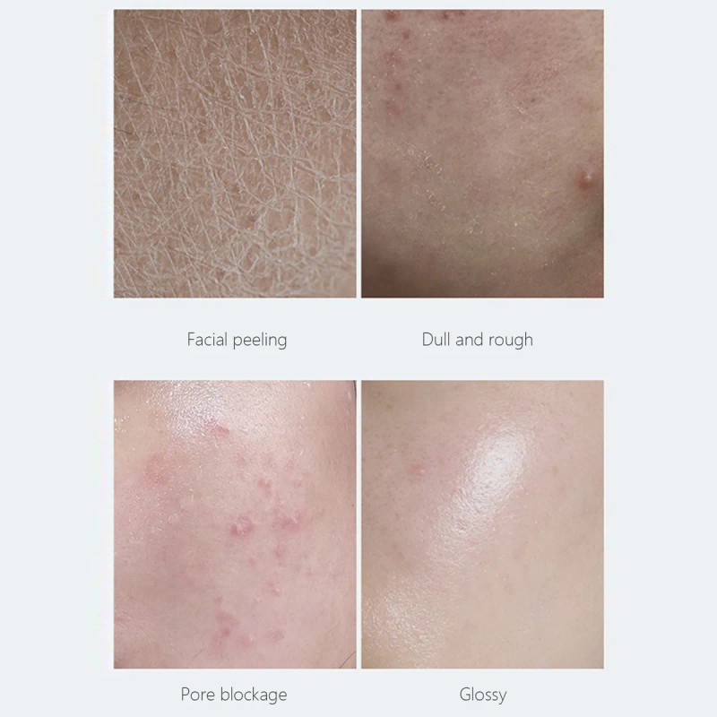 Glicerina Para Piel, Cara, Manos, Cabello, Jabones, Jabones,