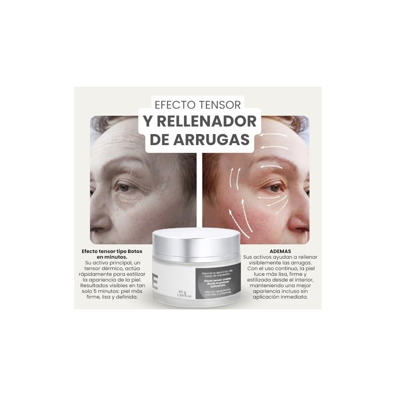 About Tenze | Crema Facial para Líneas de Expresión –