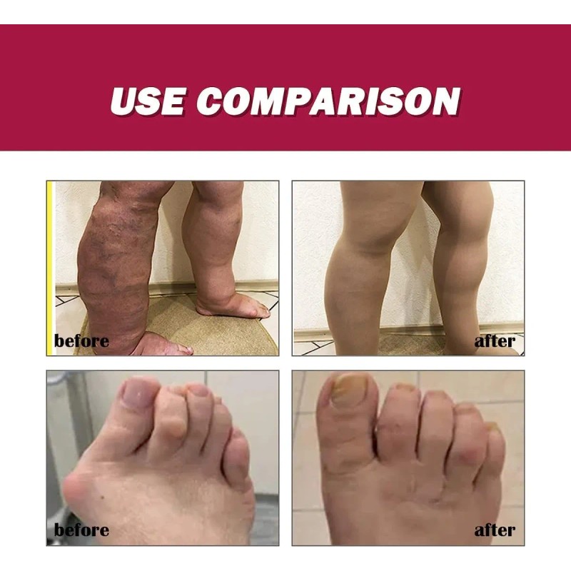 Aliviar El Dolor Crema Para El Dolor De Articulaciones 30g