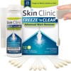 FREEZE 'n CLEAR™ Advanced Wart Remover - Tough on Warts, Gentle on Skin (12 Precision Applicators) by Skin Clinic