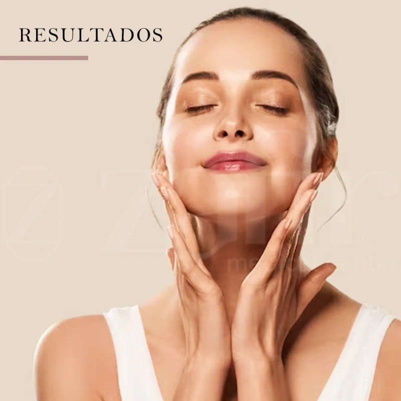 Filorga Ncef Essence Loción Rostro 150ml Hidratante Antiedad Ácido Hialurónico