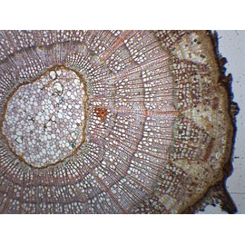 EISCO 10PK Tilia, 2-3 Year Old Stem - Cross Section - Prepared Microscope Slides - Classroom Pack, 10 Slides in Storage Case - Biology & Microscopy