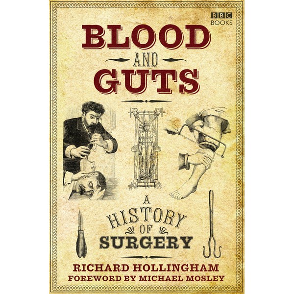 Blood and Guts: A History of Surgery