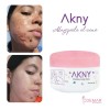 Akny Crema Para Eliminar Acné