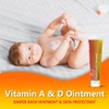 Vitamin A and D Diaper Rash Ointment Prevents & Treats