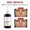 Abera Skin Renewing Serum, Melasma Treatment For Face, High-Performance Anti-Wrinkle,
