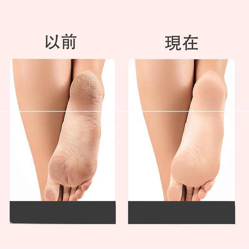 Heel Sharpener, Easy to hold, Exfoliating Device, Easy at Home,