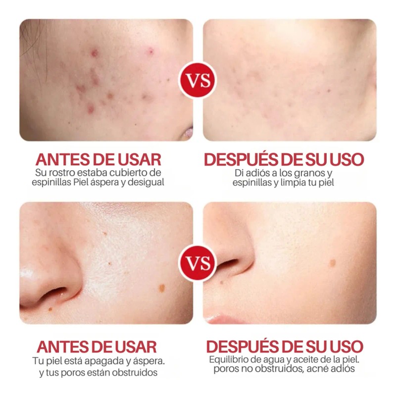 Crema Limpieza Facial Ácido Salicílico