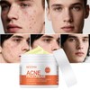 Acne Cream Multi-Acid Deep Relief – 4% Lactic Acid BHA/AHA