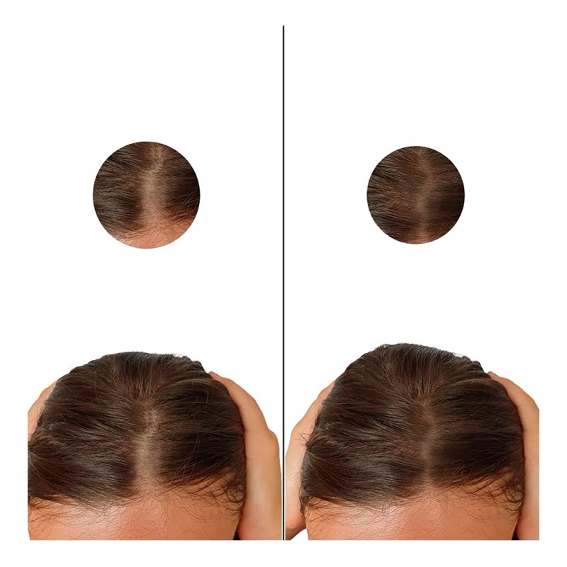 Dutasterida 0.5mg 100 Tabletas Dutaheal Sabor Sin Sabor