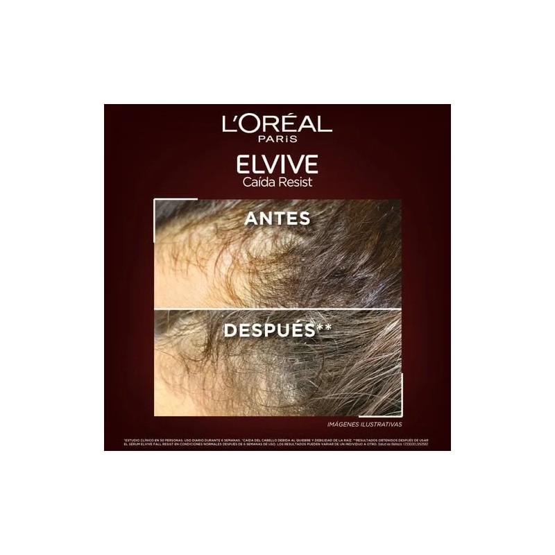 Rutina Caida Resist Con Aminexil De Elvive Con 4 Piezas