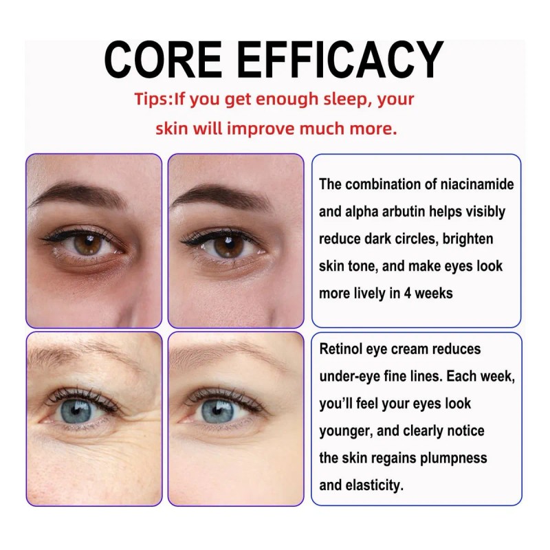 Crema Ojos Retinol 30ml Antiarrugas Antiojeras